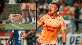 Universitario reveló la gravedad de la lesión y tiempo de recuperación de Hugo Ancajima Universitario reveló la gravedad de la lesión y tiempo de recuperación de Hugo Ancajima