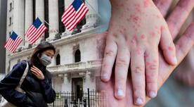 Alarmante situación en EE. UU.: país de Trump vive su peor EPIDEMIA de sarampión en más de 30 años, revela universidad Alarmante situación en EE. UU.: país de Trump vive su peor EPIDEMIA de sarampión en más de 30 años, revela universidad