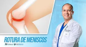 ¿Cómo saber si te rompiste el menisco?, por el Dr. Cotillo ¿Cómo saber si te rompiste el menisco?, por el Dr. Cotillo