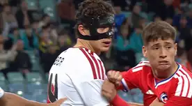 ¿Por qué Fabio Gruber jugó con una máscara en el clásico Perú vs. Chile? ¿Por qué Fabio Gruber jugó con una máscara en el clásico Perú vs. Chile?