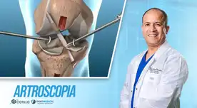 ¿Qué debes saber antes de someterte a una artroscopia?, por el Dr. Cotillo ¿Qué debes saber antes de someterte a una artroscopia?, por el Dr. Cotillo