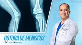 ¿Se puede vivir con el menisco roto?, por el Dr. Luis Cotillo ¿Se puede vivir con el menisco roto?, por el Dr. Luis Cotillo