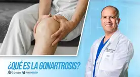¿Qué es la gonartrosis?, por el Dr. Luis Cotillo ¿Qué es la gonartrosis?, por el Dr. Luis Cotillo