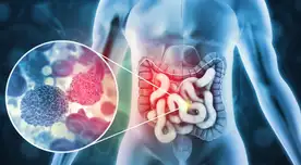 ALERTA médica en EE. UU.: baja la mortalidad por cáncer en jóvenes, pero el colorrectal crece y enciende las alarmas ALERTA médica en EE. UU.: baja la mortalidad por cáncer en jóvenes, pero el colorrectal crece y enciende las alarmas