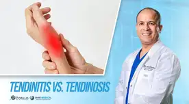 Tendinitis vs. Tendinosis, ¿cuál es la diferencia?, por el Dr. Cotillo