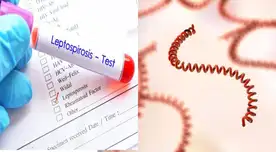 ¡Alerta en Perú! Minsa confirma 3 muertos y 841 contagios por leptospirosis que transmiten los roedores ¡Alerta en Perú! Minsa confirma 3 muertos y 841 contagios por leptospirosis que transmiten los roedores