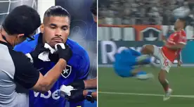 Arquero de Botafogo terminó con 15 puntos tras brutal choque con Alejandro Hohberg