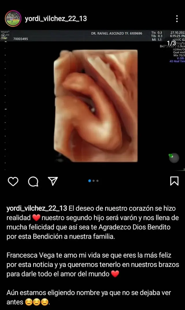 Yordi Vilchez