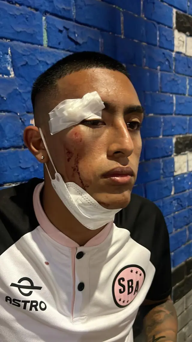 Fabrizio Roca tras ser agredido