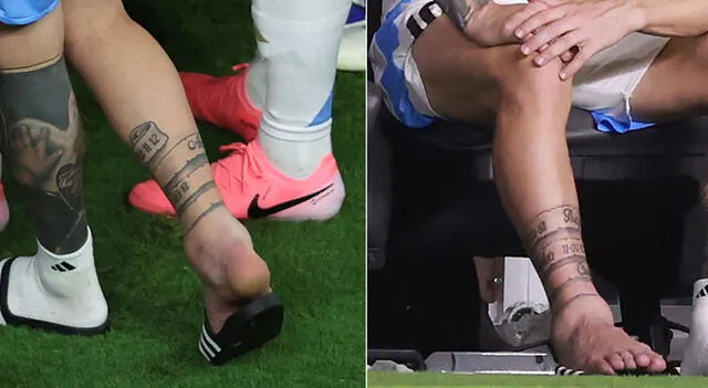 Así quedó el tobillo de Messi tras salir del Argentina vs. Colombia | Foto: AFP   