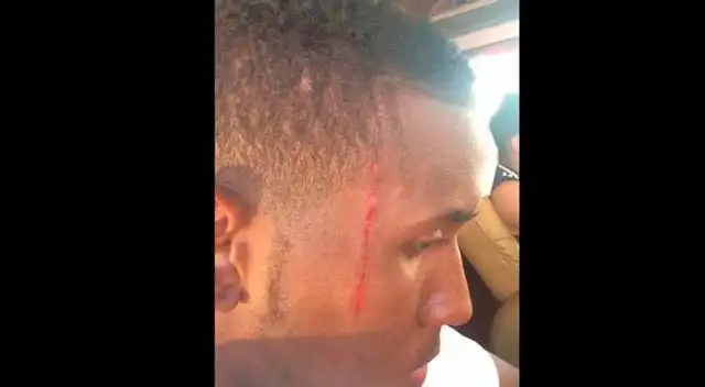 Juan Aurich vs. Sporting Cristal: Así quedó el rostro del zaguero, quien se les ha jurado en el partido de vuelta a chiclayanos.