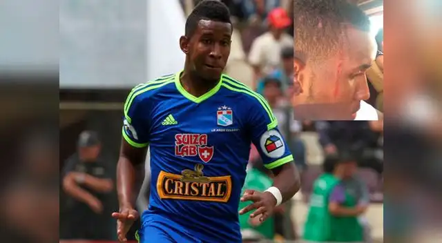 Juan Aurich vs. Sporting Cristal: Marco Ortiz terminó con un corte en el rostro tras el encuentro