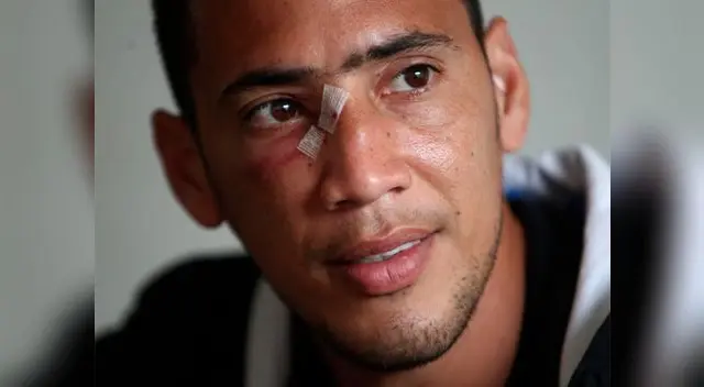Universitario: Así quedó Braynner García tras choque con Carando del Real Garcilaso Universitario: Así quedó Braynner García tras choque con Carando del Real Garcilaso
