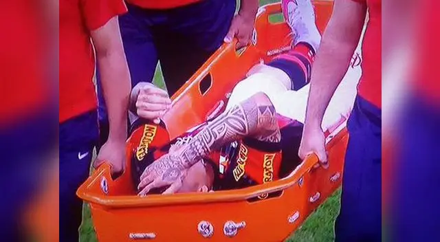 Flamengo vs. Vasco da Gama: Paolo Guerrero salió lesionado y preocupa para amistosos de Perú Flamengo vs. Vasco da Gama: Paolo Guerrero salió lesionado y preocupa para amistosos de Perú