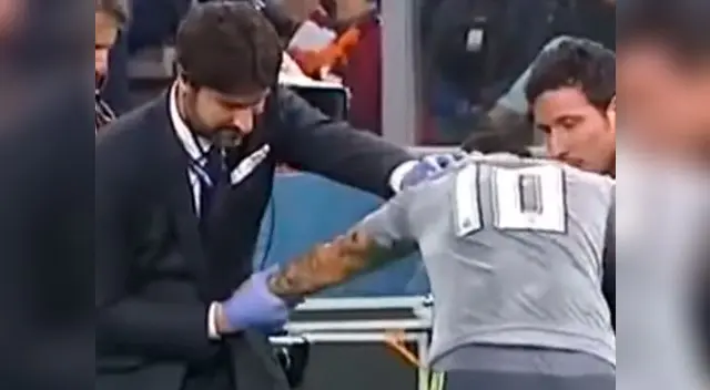 James Rodríguez se dislocó el hombro y médico así se lo acomodó | VIDEO