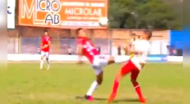 Universitario: así quedó Roberto Siucho tras planchazo de Ángel Ojeda. Universitario: así quedó Roberto Siucho tras planchazo de Ángel Ojeda.