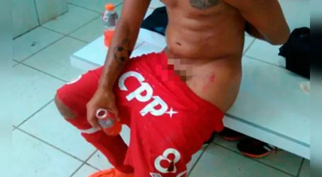 Universitario: así quedó Roberto Siucho tras planchazo de Ángel Ojeda. Universitario: así quedó Roberto Siucho tras planchazo de Ángel Ojeda.