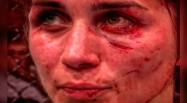 UFC: mira cómo quedó el rostro de Verónica Macedo tras perder ante Ashlee Evans-Smith | FOTOS. UFC: mira cómo quedó el rostro de Verónica Macedo tras perder ante Ashlee Evans-Smith | FOTOS.