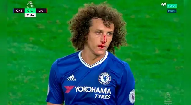 David Luiz con la cara ensangrentada en el Chelsea-Liverpool. David Luiz con la cara ensangrentada en el Chelsea-Liverpool.