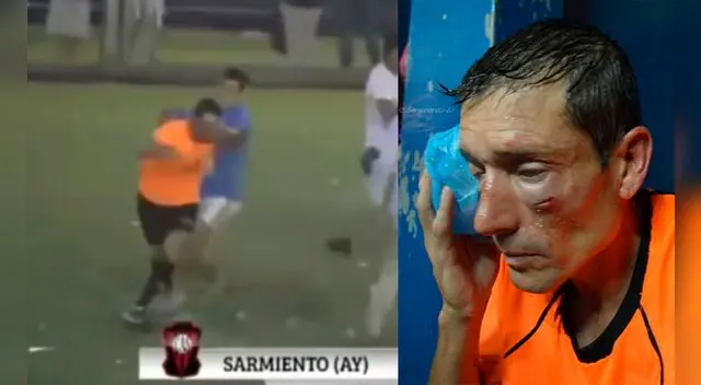 Así quedó Claudio Elichiri, árbitro de la Federal B de Argentina, tras brutal agresión de hinchas. 
