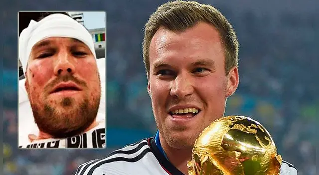 Kevin Großkreutz, campeón del mundo con Alemania, fue despedido del Stuttgart tras una pelea nocturna