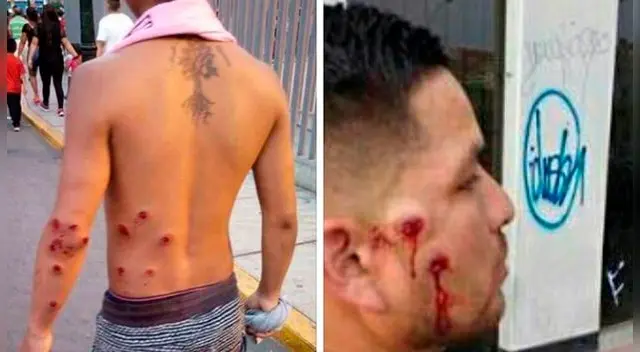 Sport Boys: Policía Nacional cometió terribles abusos contra hinchas en la “Noche Rosada” Sport Boys: Policía Nacional cometió terribles abusos contra hinchas en la “Noche Rosada”