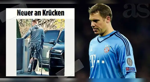 Manuel Neuer camina con dificultad y se perdería el duelo ante el Real Madrid. Manuel Neuer camina con dificultad y se perdería el duelo ante el Real Madrid.