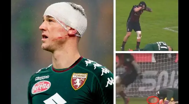 Gianluca Lapadula le causó un corte a Joe Hart en un partido de Copa Italia del año pasado. Gianluca Lapadula le causó un corte a Joe Hart en un partido de Copa Italia del año pasado.