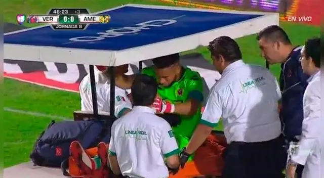 Pedro Gallese salió lesionado en el partido del Veracruz ante América. Pedro Gallese salió lesionado en el partido del Veracruz ante América.