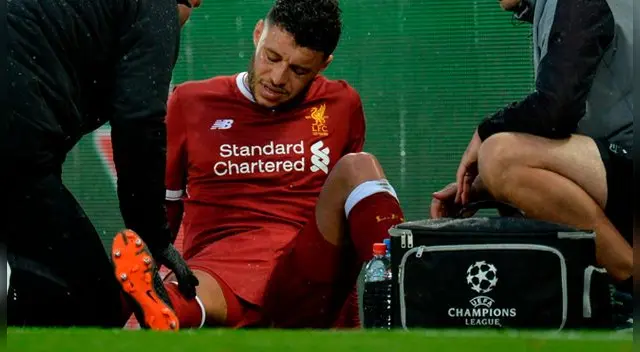 Liverpool confirmó que Alex Oxlade-Chamberlain se pierde lo que resta de la Champions League y el Mundial Rusia 2018 Liverpool confirmó que Alex Oxlade-Chamberlain se pierde lo que resta de la Champions League y el Mundial Rusia 2018