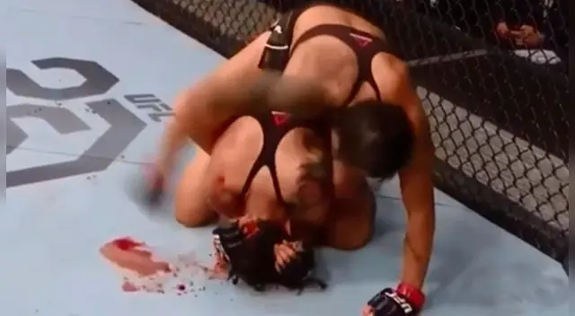 Raquel Pennington tuvo que ser traslada a un hospital luego de la pelea. Raquel Pennington tuvo que ser traslada a un hospital luego de la pelea.