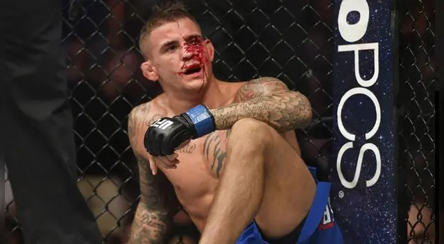 Dustin Poirier quedó fuera de la pelea con Nate Diaz en el UFC 230 por una lesión