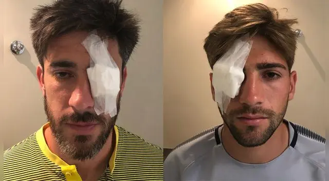 River Plate vs Boca Juniors: médicos advierten a Conmebol que jugadores no están en condiciones de jugar | Final Copa Libertadores