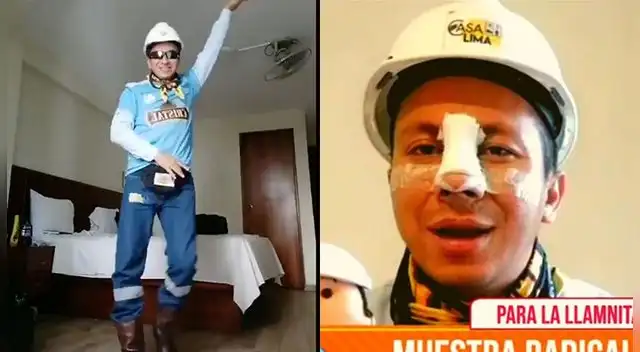 El ingeniero se operó la nariz y se someterá a más cambios.