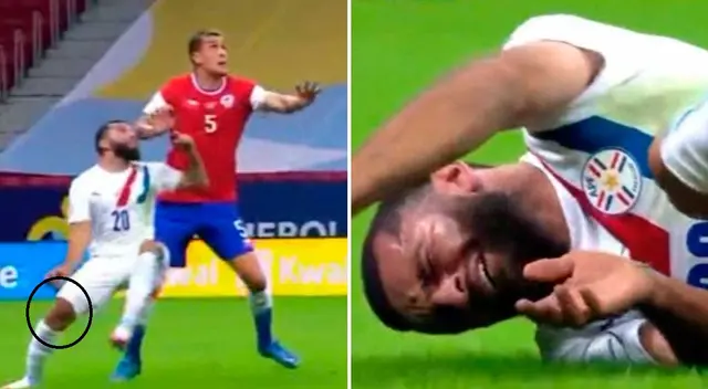 Entre lágrimas: la terrible lesión que sufrió Antonio Bareiro en el Chile vs Paraguay Entre lágrimas: la terrible lesión que sufrió Antonio Bareiro en el Chile vs Paraguay