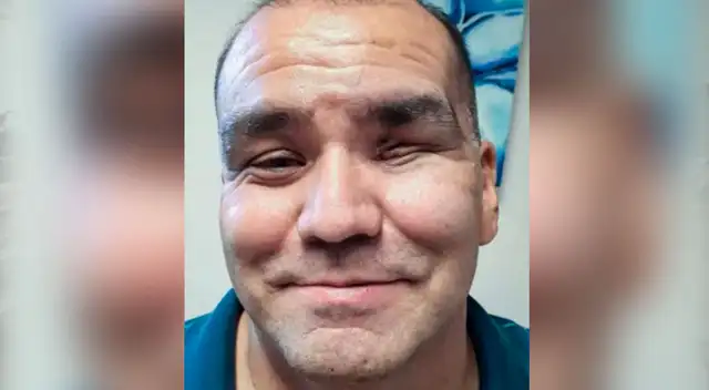 sobreviviente del hongo negro y al Covid-19