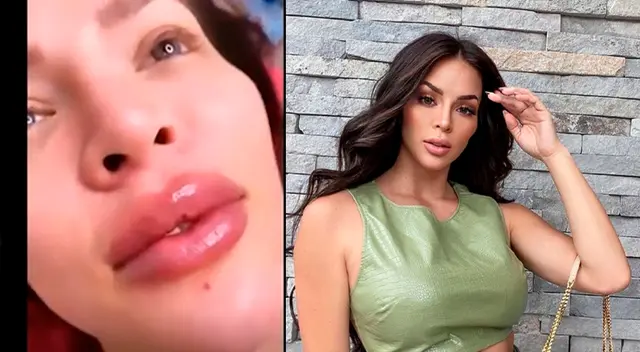 Sheyla Rojas mostró sus nuevos retoques. Sheyla Rojas mostró sus nuevos retoques.