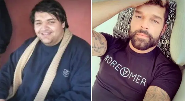 Fan de Ricky Martín se operó más de 20 veces para parecer a su ídolo Fan de Ricky Martín se operó más de 20 veces para parecer a su ídolo