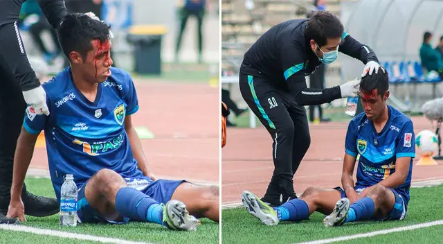 Brandon Palacios terminó con la cabeza rota