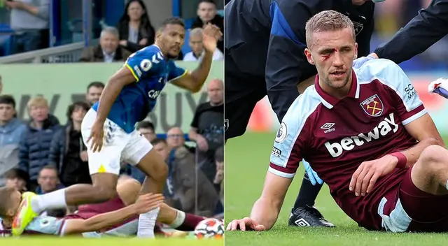 West Ham se impuso por la mínima diferencia sobre el Everton.