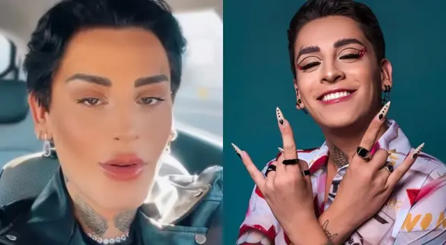 Kunno se quedó sin sonrisa tras someterse a un tratamiento estético Kunno se quedó sin sonrisa tras someterse a un tratamiento estético