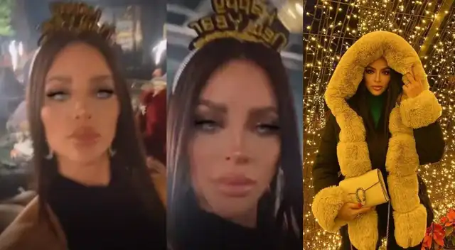 Sheyla Rojas ya no tiene líneas de expresión tras tratamiento estético