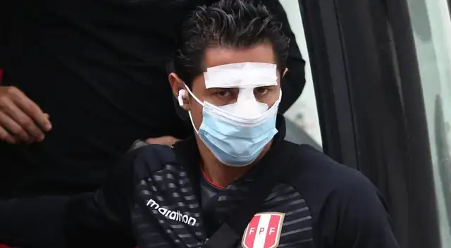 Lapadula no se operara la nariz.