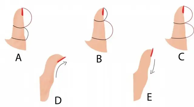 Test de personalidad: Descubre más sobre ti con la forma de tus pulgares Test de personalidad: Descubre más sobre ti con la forma de tus pulgares