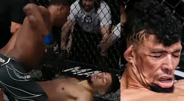 Así quedó el rostro de Johnny Walker tras sufrir un impactante nocaut