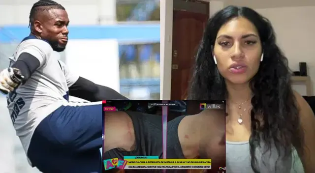 Amor y Fuego: Xamia Rodriguez acusa de agresión a futbolista Christian Ortiz Amor y Fuego: Xamia Rodriguez acusa de agresión a futbolista Christian Ortiz