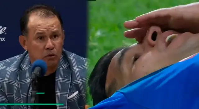 Juan Reynoso habló sobre Luis Abram tras golpe en la nariz Juan Reynoso habló sobre Luis Abram tras golpe en la nariz