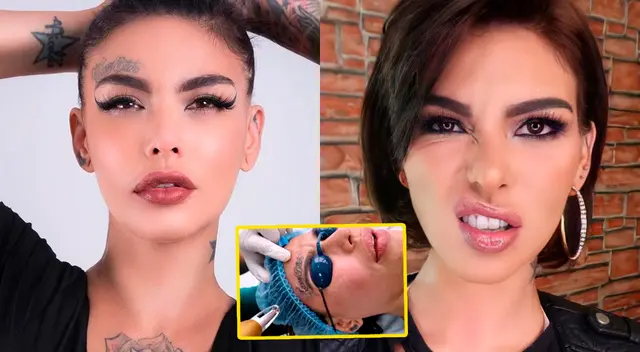 La controversial modelo decidió borrar todos sus tatuajes. La controversial modelo decidió borrar todos sus tatuajes.