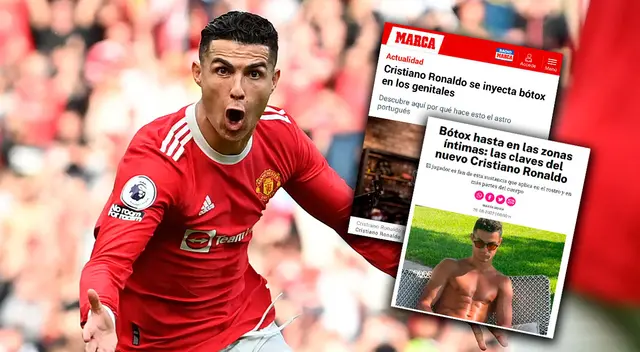 Medios españoles señalan que Cristiano Ronaldo se inyecta bótox en sus partes íntimas Medios españoles señalan que Cristiano Ronaldo se inyecta bótox en sus partes íntimas