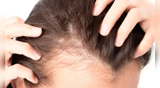 Cómo se dice según la RAE: ¿pelo o cabello? Cómo se dice según la RAE: ¿pelo o cabello?